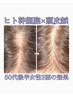 【育毛促進】ラボ直送100％原液ヒト幹細胞上清液4cc【ヒト幹細胞×頭皮鍼】