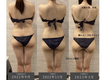 ラヴニール(L'avenir)