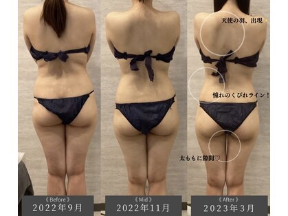 ラヴニール(L'avenir)の写真