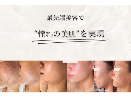 リレイス(Relace)の写真