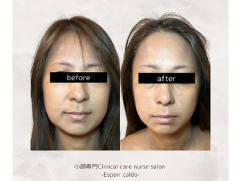 エスポワールカルド(Espoir caldo)/