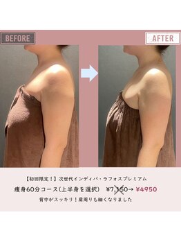 マーリエ(Malie)/【ラフォス】二の腕