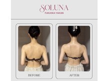 ソルナ 福岡薬院店(SOLUNA)/【2月～3月】