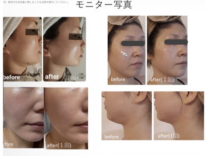 オチョビー(ocho.bee)の写真