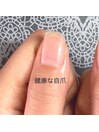 健康な自爪は艶があって綺麗