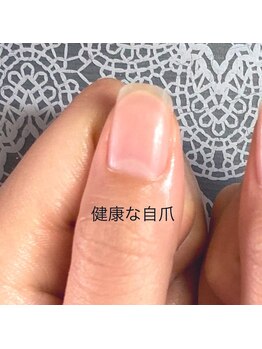 健康な自爪は艶があって綺麗