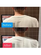 ナオル整体 宮崎院(NAORU整体)/40代男性施術事例【肩の高さ】