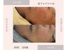 イーサロン(eii salon)の雰囲気（しみ・赤み・くすみもケア、リフトアップまで叶う◎）