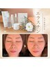 【新規】ハリ・たるみ｜ふっくら弾力フェイシャル＋毛穴洗浄付き♪¥12,000→