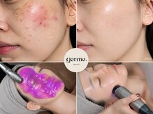 ジェルム(germe.)
