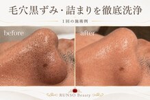 ランソ ビューティー 成田(RUNSO Beauty)
