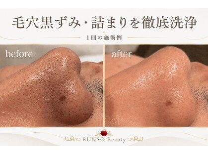 ランソ ビューティー 成田(RUNSO Beauty)の写真
