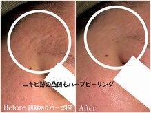 クラン 森ノ宮店(Clan)の雰囲気(剥離ありハーブピーリング!ハイドラ付!2回目以降もお得)
