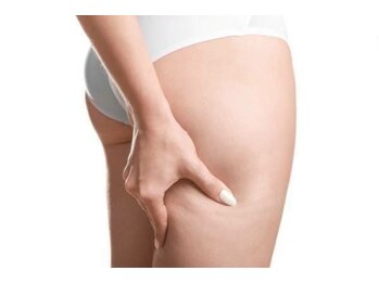 ヨサパーク モク 茶 武蔵新田店(YOSA PARK MOKU)の写真/夢の美脚&ヒップラインへ!基礎体温を上げて脂肪燃焼を促す温活ダイエットで、たるみを改善◎