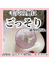 エクラーレ(Eclale)/【毛穴ケア】症例