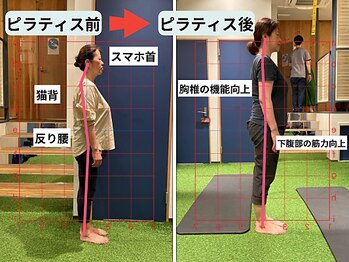 ファクト(fact)/猫背、反り腰、巻き肩が解消!