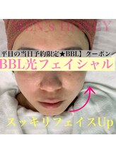 ハニーアイズ(Honey Eyes)/【BBLフェイシャル体験】