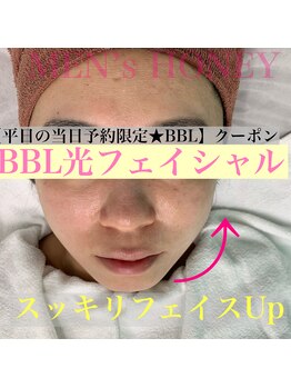 ハニーアイズ(Honey Eyes)/【BBLフェイシャル体験】