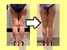 ビオール 池袋店(beall)/大人気！オーダーメイド痩身90分