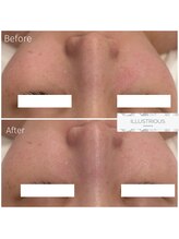 クレア(Clair)/イラストリアス症例