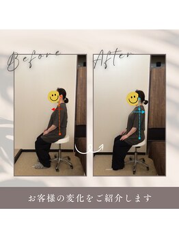 アルク美容整体院(ARUKU美容整体院)/★姿勢が整うと、こんなに変わる
