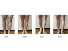 リツイート(ReTweet)/口コミ５，０☆