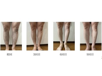 リツイート(ReTweet)/口コミ5,0☆