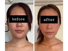 ヨサパーク リアン(YOSA PARK Lien)/モニター様before→after/痩身