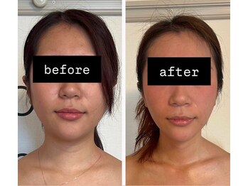 ヨサパーク リアン(YOSA PARK Lien)/モニター様before→after/痩身