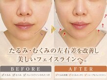 ステラ グランデ 福岡博多/小顔矯正で叶えるフェイスライン