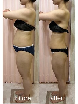 アコラージュ/全身ハイパーナイフコース