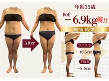ザ ラウラ ビューティー ボディ(THE LAULA BEAUTY)/35歳【ブライダル】
