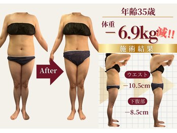 ザ ラウラ ビューティー ボディ(THE LAULA BEAUTY)/35歳【ブライダル】