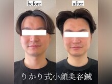 りかり 明石大久保院/メンズも美容の時代です！