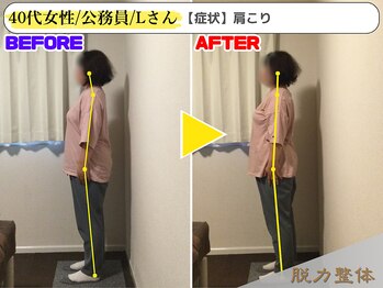 幸せのもり整体院/40代女性/公務員/Lさん