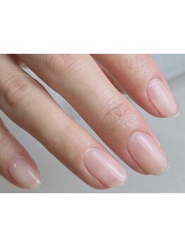 爪の悩みを解消できる（ケア含む）