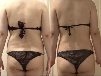 上野エステサロン レア(Lea)の写真/【上野トップクラス◇セル脂肪撃退！】全国痩身コンテスト入賞の実力派サロン！痩身の事はお任せください♪