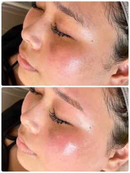 ルブニール(Lubenir.)/★フルフェイスwax★