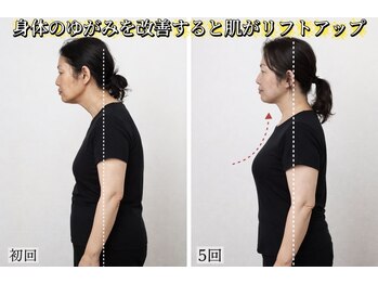 サロンチオリ 烏丸(Salon Chiori)/猫背・出っ張りお腹を骨盤から