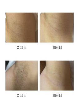 リツイート(ReTweet)/口コミ5,0☆