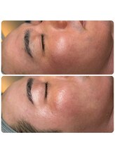 エミレーブ シロカネ(Hemireve Shirokane)/今必要なケアをたっぷりと