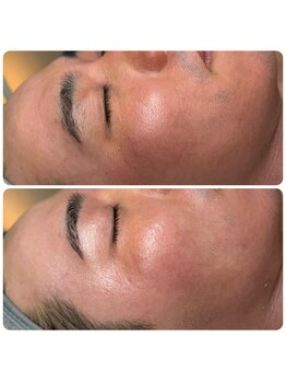 エミレーブ シロカネ(Hemireve Shirokane)/今必要なケアをたっぷりと