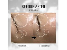 マカナ(Makana)の雰囲気(韓国から日本に上陸!お肌のトラブルを内側から肌質改善します!)