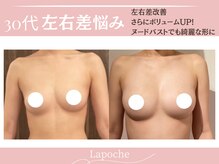 ラポッシュ(La poche)の雰囲気（バストアップ/バストケア/左右差/離れ乳/下垂/産後ケア/ハリ）