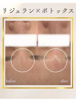 グラシア(gracia)の写真/30・40代から気になり始めるハリ不足・乾燥・小ジワ・毛穴に。
