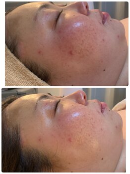 シェルビー(Cielbe.)/陶肌トリートメント