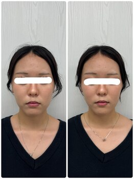 ラフテル鍼灸整骨院/全日8時～22時まで美容鍼可能！