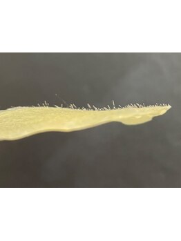 顔脱毛がしたい