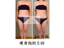 アイ エステサロン(Ai)/【３０代】産後ダイエット腰回り