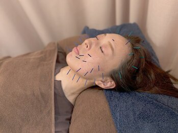 こじま 富雄団地接骨院/ヒト幹細胞美容鍼